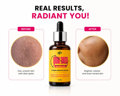 GLOW AWAY - Brightening Serum