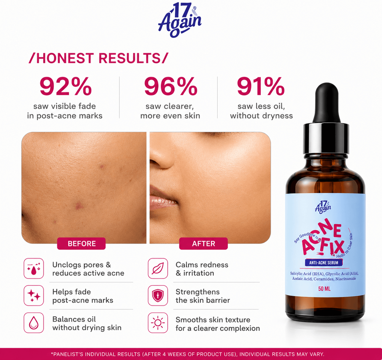 ACNE FIX - Anti Acne Serum