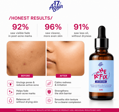 ACNE FIX - Anti Acne Serum